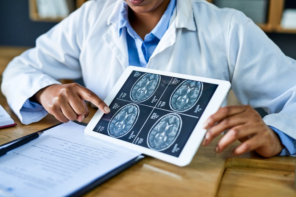 should I see a neurologist after an accident?